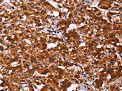 ART5 Antibody