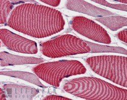 AS160/TBC1D4 Antibody