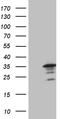 ASB2 Antibody