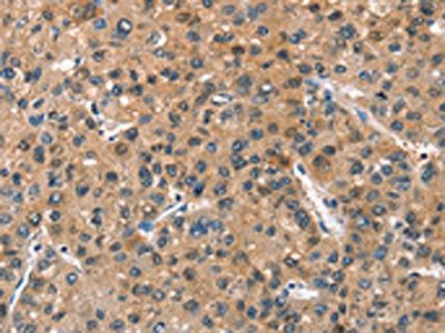 ASB2 Antibody