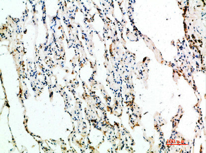 ASCL1 Antibody