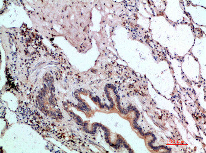 ASCL1 Antibody