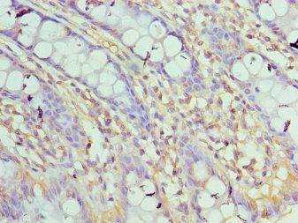 ASF1A Antibody
