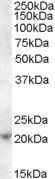 ASF1A Antibody