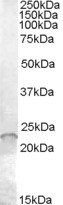 ASF1A/HSPC146 Antibody