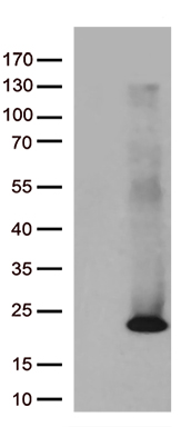 ASF1B Antibody