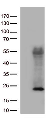 ASF1B Antibody