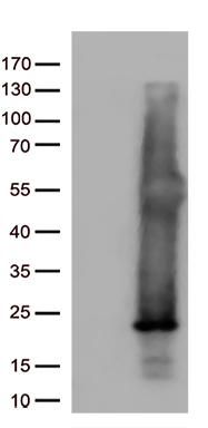 ASF1B Antibody