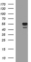 Asialoglycoprotein Receptor 2 Antibody