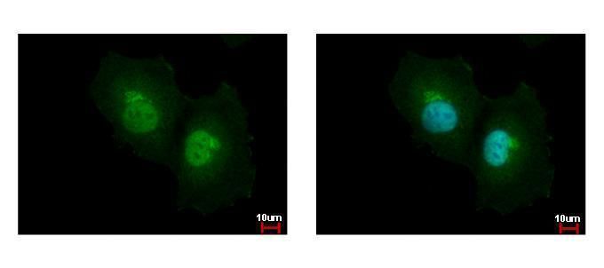 ASL Rabbit Polyclonal Antibody