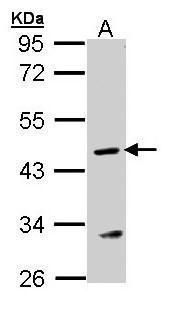 ASL Rabbit Polyclonal Antibody