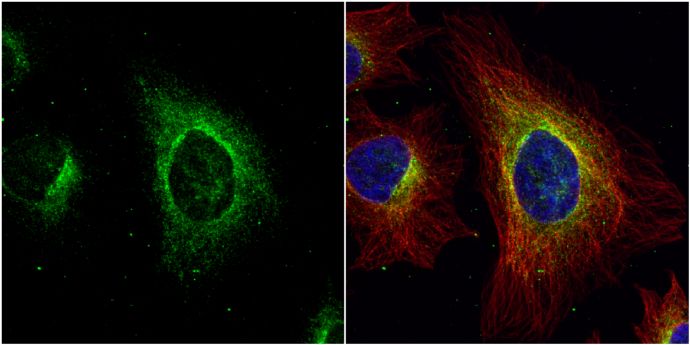 ASL Rabbit Polyclonal Antibody
