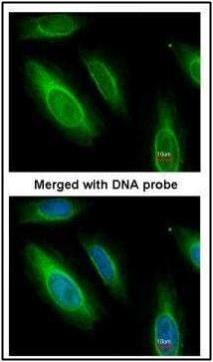 ASL Rabbit Polyclonal Antibody