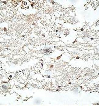 ASRGL1 Rabbit Polyclonal Antibody