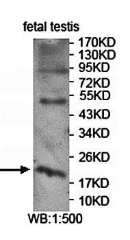 ASRGL1 Rabbit Polyclonal Antibody