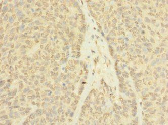 ASZ1 Antibody