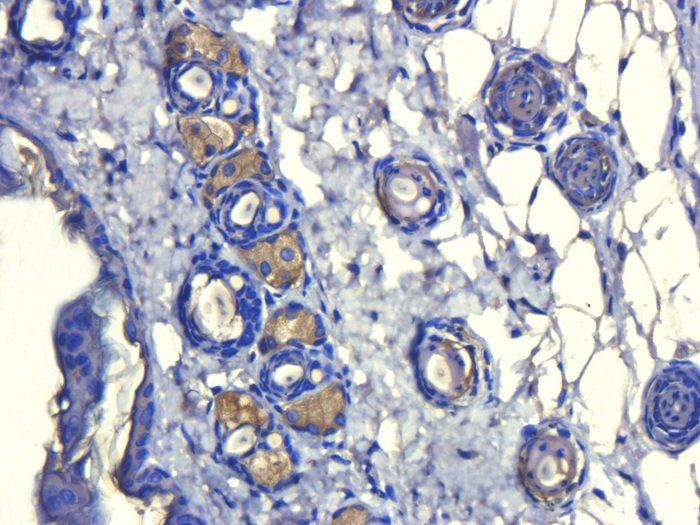 ATAD2 Antibody