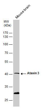 Ataxin 3 antibody