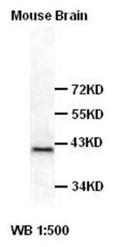 Ataxin 3 Rabbit Polyclonal Antibody