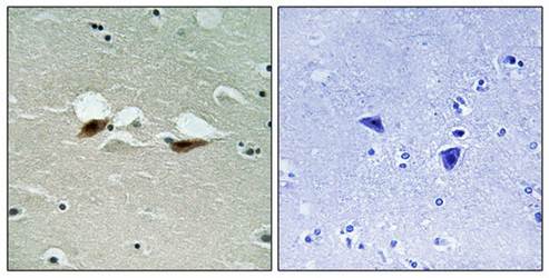 ATF-2 (Phospho-Ser472) Antibody