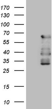 ATF1 Antibody