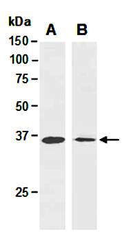 ATF1 (N) Antibody, Rabbit Polyclonal