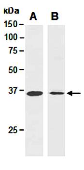 ATF1 (vPairTM) Antibodies