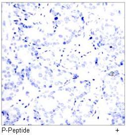 ATF2 (Phospho-Thr73 or 55) Antibody