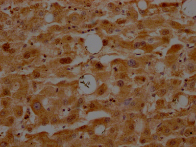 ATF5 Antibody