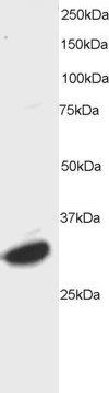 ATF7 Antibody