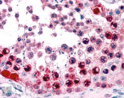 ATF7 Antibody