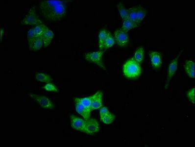 ATG16L1 Antibody