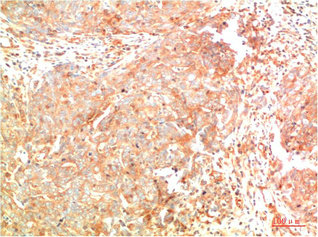 ATG7 Antibody