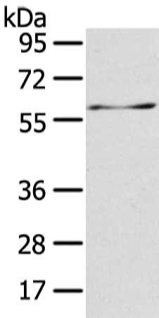 ATIC Antibody