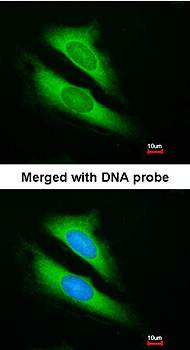 ATIC Rabbit Polyclonal Antibody
