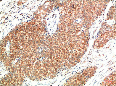 ATM Antibody