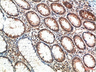 ATM Antibody