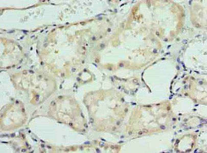 DHX9 Antibody