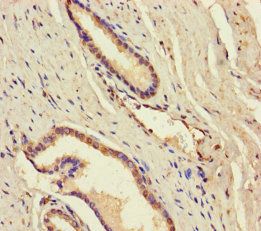 DDX19A Antibody