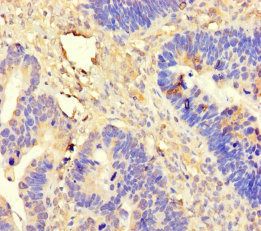DDX19A Antibody