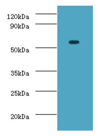 DDX19A Antibody (FITC)