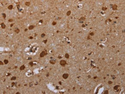 ATP2A1 Antibody