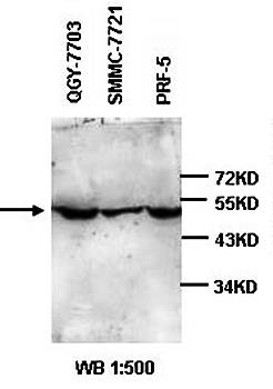 ATP5B Rabbit Polyclonal Antibody