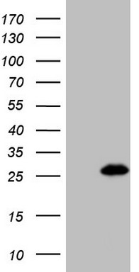 ATP5O Antibody