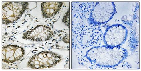 ATR (Phospho-Ser428) Antibody