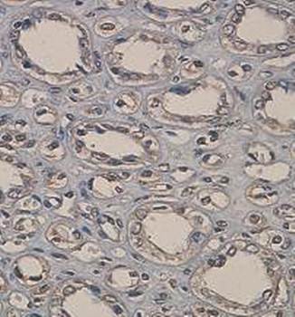 ADAMTS5 Rabbit Polyclonal Antibody