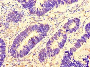 AURKA Antibody