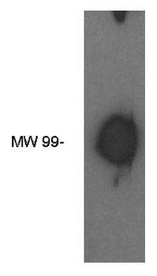 Rabbit Human Autotaxin Antibody