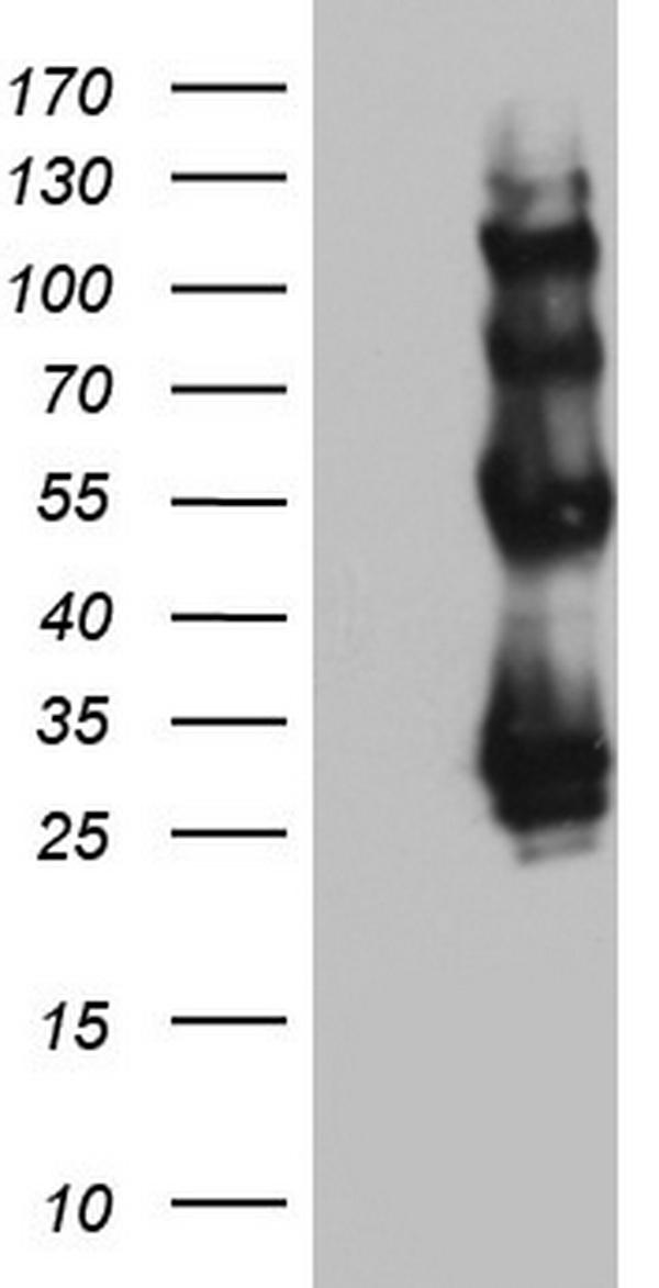 AVPI1 Antibody