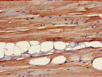 B3GALT4 Antibody